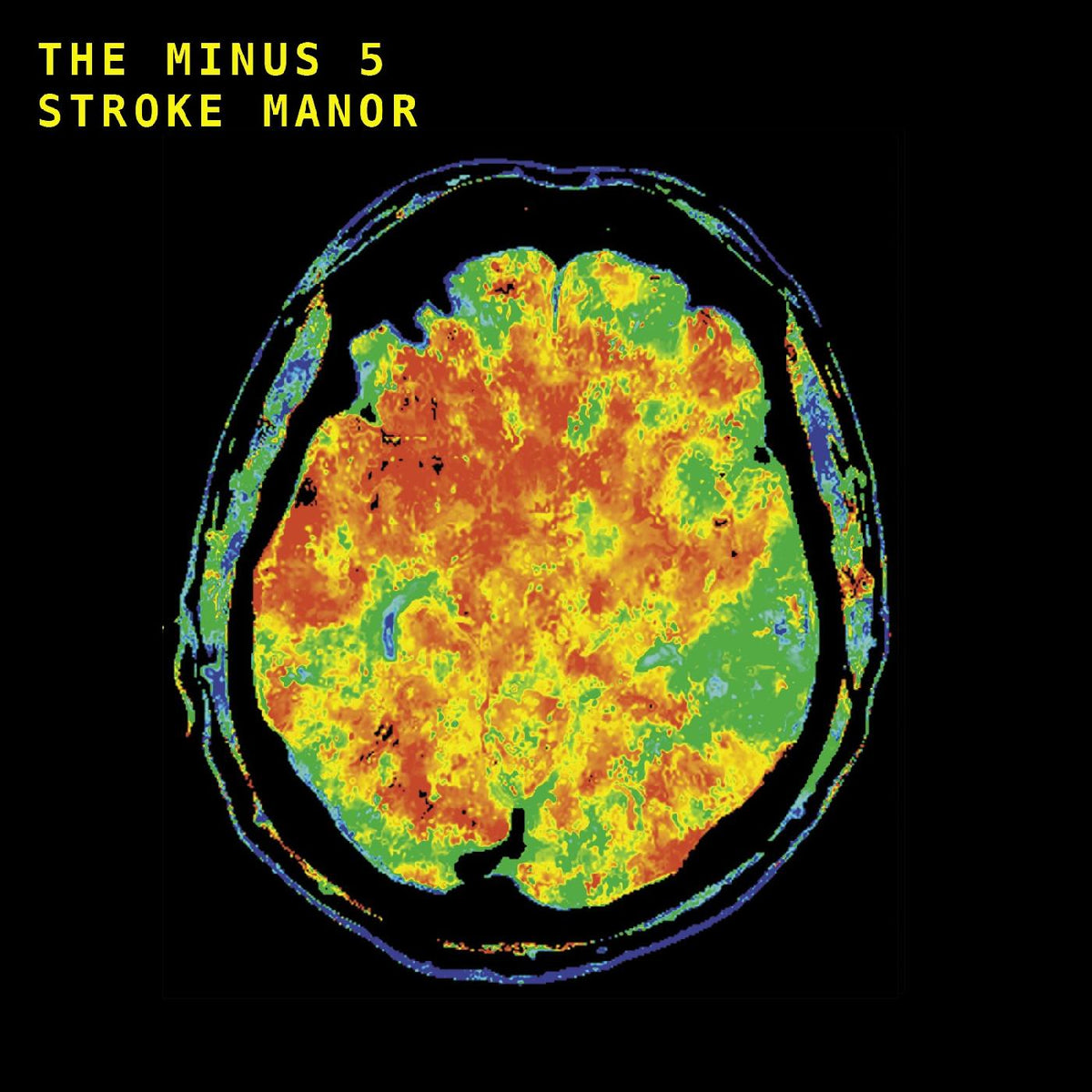 STROKE MANOR - Front Cover