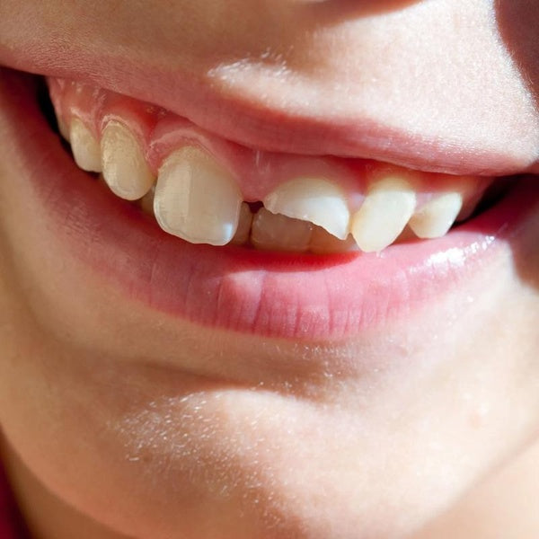 Smiling Through The Pain - Front Cover