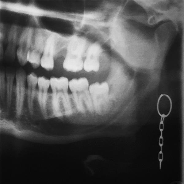 Hollow Head - Front Cover