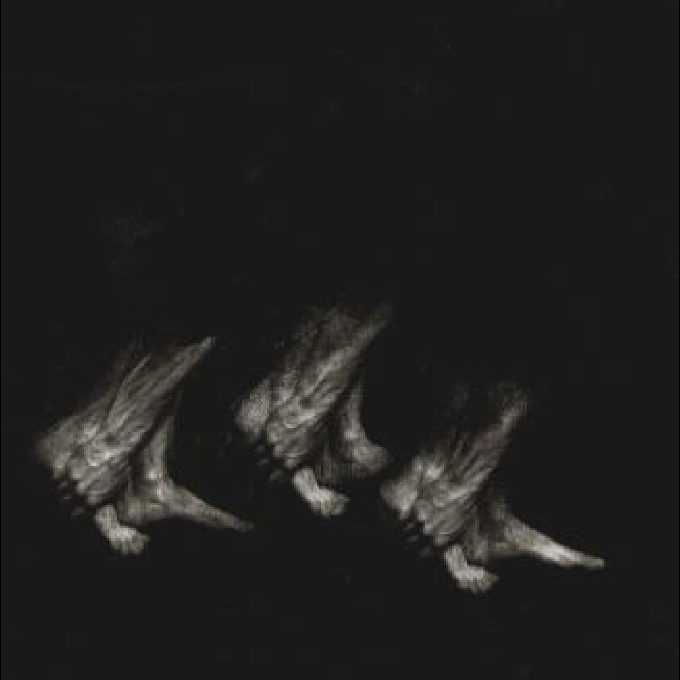 PROCESSION - Front Cover