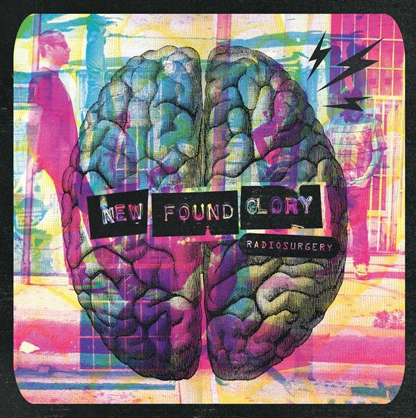 Radiosurgery - Front Cover